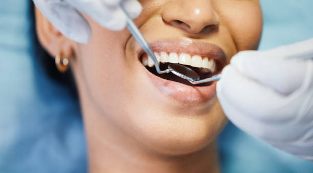 Best Emergency Tooth Extraction in Deshler, OH