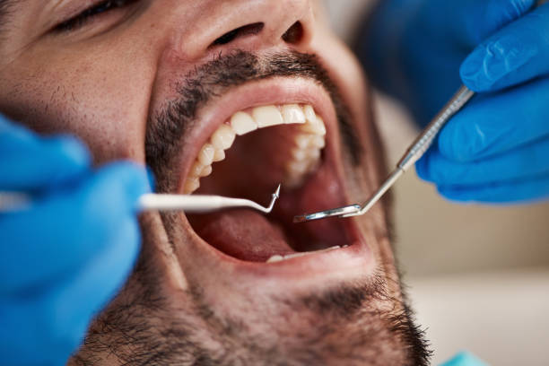 Best Pediatric Emergency Dentist in Deshler, OH